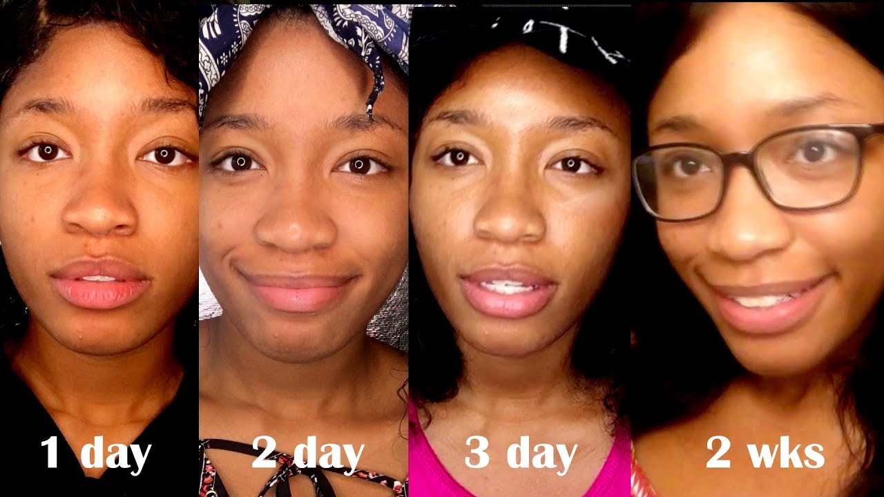 Aztec Secret Before & After [Top Genuine Results] OBS Cosmetic Blog